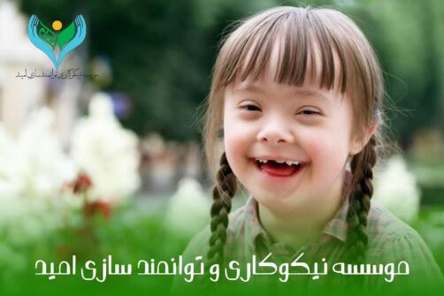 کودکی که سندرم داون دارد